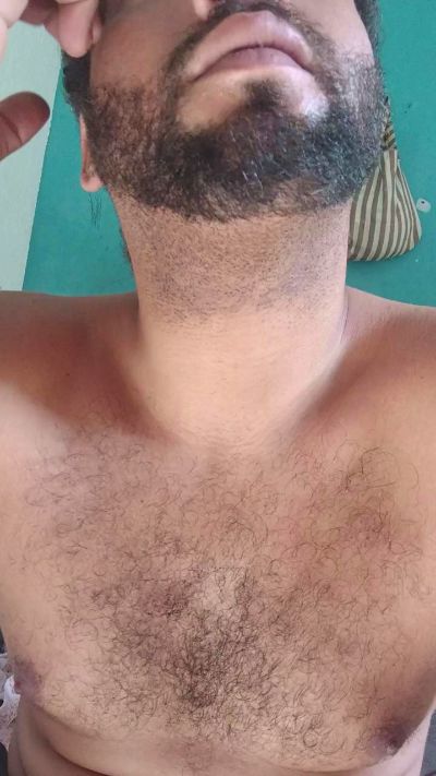 Oi2rr from Brazil